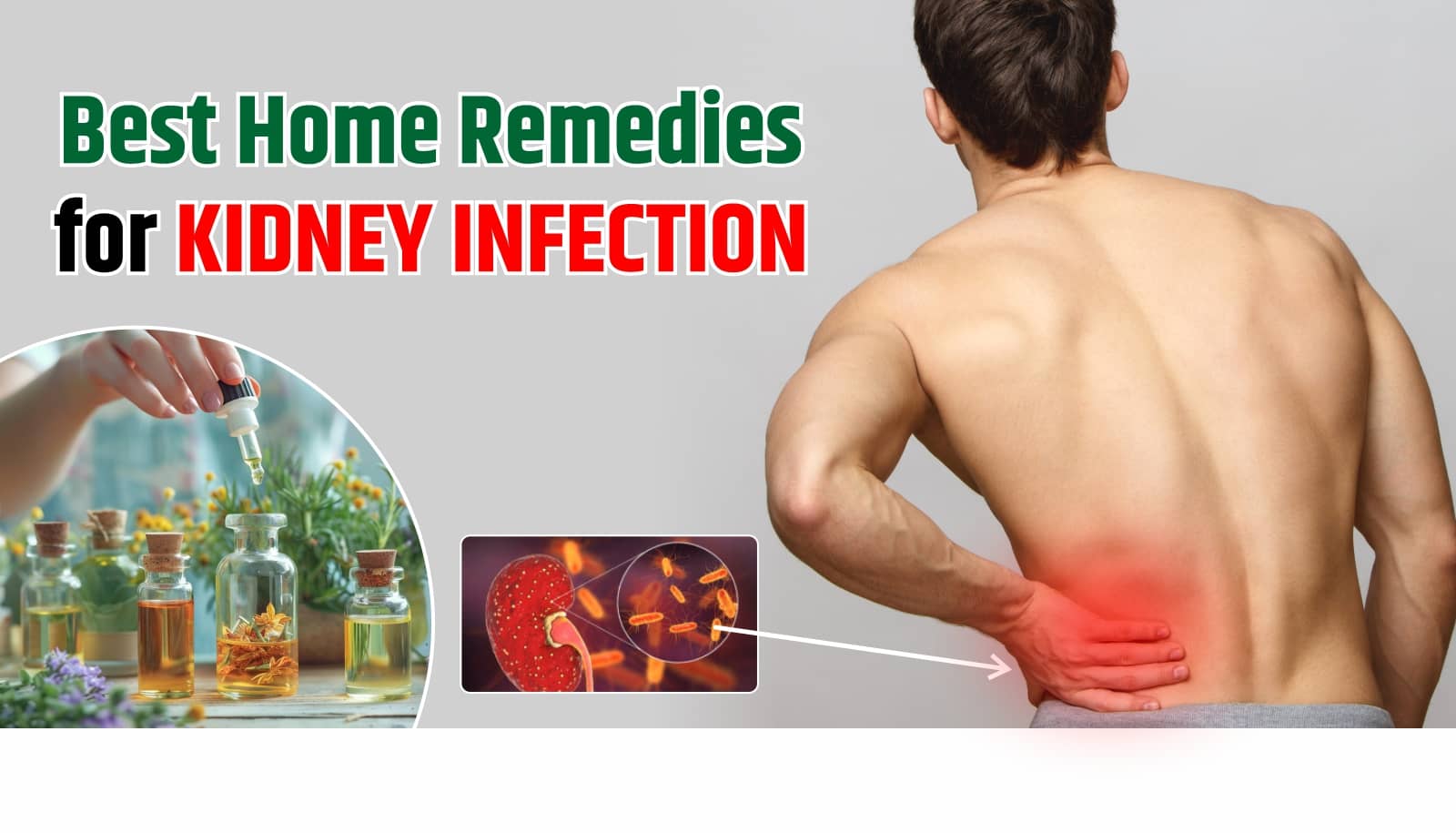 Best Home Remedies for Kidney Infection